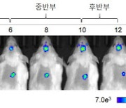 "신체염증이 우울증 유발한다"