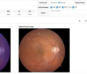 강북삼성병원, 안과 질환 자동 진단..딥러닝 알고리즘 개발