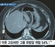 [쿠키건강뉴스] "폐경 후 비만 심할수록 암 발생 위험 증가"
