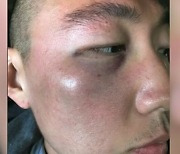 "중국 바이러스" LA 한인타운서 한국계男 무차별 폭행 당해