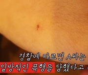 "장제원 아들 장용준이 일방적 폭행" 피해자가 공개한 사진