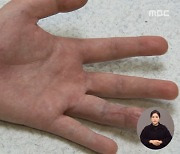 [제보는 MBC] 택배 분류하다 손가락 잘렸는데.."그냥 참고 일해"