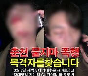 "괴한이 얼굴 짓밟고 걷어차" 춘천 묻지마 폭행 '경찰 수사'