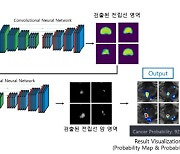 제이엘케이, 전립선암 영상 진단보조 소프트웨어 식약처 허가