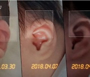 "4월 중순 왼쪽 귀 모양 달라졌다" 보람양 사건 다룬 '그알' 분석