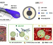 포스텍, 머릿속 시한폭탄 '뇌동맥류' 새로운 치료법 개발