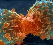 전립선암 진단제·세포 표적 치료제 국산화 전망