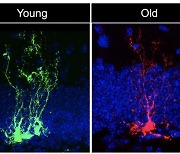 나이 들면 늙는 뇌..신경줄기세포 통해 '회춘' 가능해진다