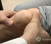 '염증·통증' 무릎관절증 환자 매년 증가..2019년 295만명 진료