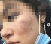 한국계 10대 여성에 "北 매춘부"..욕설 퍼붓고 폭행한 흑인