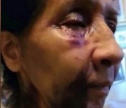 "당신 아시아계 아냐?" 멕시코계 할머니, 오인 폭행 당했다
