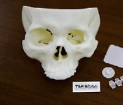 티앤알바이오팹, 뼈재생 돕는 3D 프린팅으로 中·유럽 진출