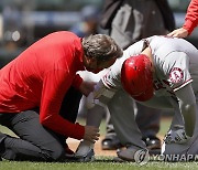 공에 맞은 오타니..4일 MLB 선발 등판 불투명