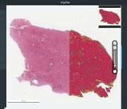 뷰노, ASCO 2021서 AI 기반 간암 연구결과 발표
