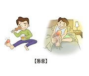 "통풍 2약 칵테일, 치료 효과 2배 상승"