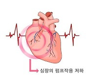 "심부전, 암보다 우울증 위험 높아"