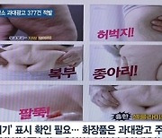 [쿠키건강뉴스] '흉터 치료'·'지방 감소' 온라인 과대광고 377건 적발