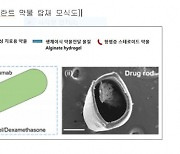 세계 첫 '안구 임플란트'..황반변성 치료 트렌드 바뀌나