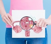 초기 자궁내막암, '프로게스틴' 치료해도 안전하게 임신