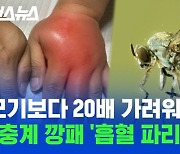 [스브스뉴스] 여름 벌레 끝판왕! 생살 찢어 피 빠는 한국 흡혈 파리 클라스;;