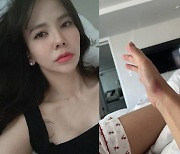 '레이먼킴♥' 김지우, 새파랗게 멍든 손.."언제 어디서 생긴 거니"