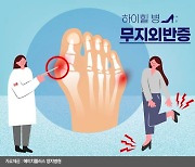 여름철, '예쁜 발' 뽐내다 '못난 발' 될 수 있다.