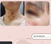 "여친과 헤어져 화나" 처음 본 여성 무차별 폭행한 20대 남성