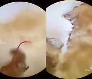 생선살 튀김에 콕콕 박힌 플라스틱.. 과학자가 띄운 충격 영상