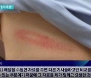 "배달 거리보다 돈 적다" 따진 라이더에 사장이 집까지 찾아와 둔기 폭행