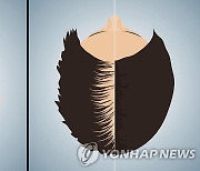 지난해 탈모 환자 23만명, 4년전보다 10%↑..30대가 가장 많아