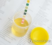 탁하고 냄새나는 소변, 방광염 의심해야..방치하면 신장염 된다