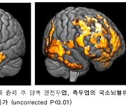 왓슨앤컴퍼니 '포커스', 전전두엽·측두엽 국소뇌혈류 증가 확인