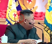 북한 김정은, 뒤통수에 붙인 파스 눈길