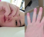 '예비 삼둥이맘' 황신영, 손발이 퉁퉁.."이제부터 한 달이 고비"