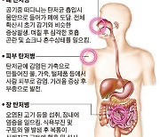 중국, 코로나 이어 탄저병에도 뚫렸다