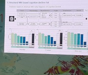 뉴로핏, 'KCR 2021'서 AI기술 활용한 뇌질환 진단.예후 예측 연구결과 발표