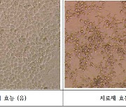 나눔제약, 천연물 코로나19 치료제 후보물질 델타변이 억제 효과 확인