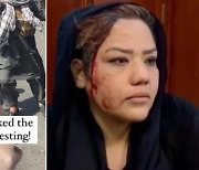 탈레반, 반파키스탄 시위대에 발포·부상자 속출..참가자 대부분 여성