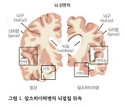 할머니가 손주인 저를 못 알아보세요, 어떻게 해야 하죠? [의사에게 듣는 '질환' 이야기]