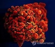 '세계 최다 HIV 감염국' 남아공 코로나19와의 싸움에 지장