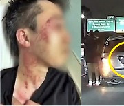 [영상] 차 유리 깨부수며 "중국X, 죽이겠다"..美서 아시아인 무차별 폭행