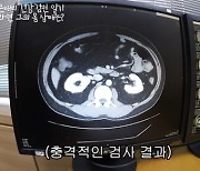 '이지혜♥' 문재완, 충격적 건강 상태..내장비만→고혈압 "종합병원 수준"