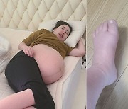 '세쌍둥이 임신' 황신영 103kg 근황.."코끼리처럼 퉁퉁 부은 발"