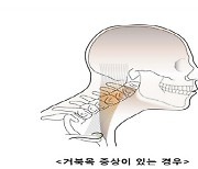 재택근무·IT기기 사용 증가에 척추 건강 '주의보'