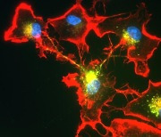 뇌의 독성 단백질 분해하는 면역세포 '분업 시스템' 발견
