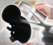 "다운증후군 태아 낙태 시기 차별적" 제소..재판부 "아이·여성 권리 균형 위해"