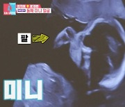 '동상이몽2' 이지혜♥문재완, 태아 초음파 확인→50년 후 사진[별별TV]