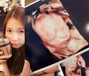 '장승조♥' 린아, 둘째 임신..'로아' 초음파 사진 공개 "무대는 잠시만 안녕"