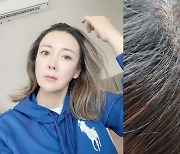 이상아, 50세에 헤어 증모시술 "머리카락 많이 빠져서..신경 많이 쓰여"