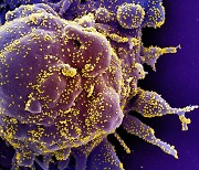 '변이'로 더 강해진 바이러스, 전문가들 "'빠르게' 백신 미접종자 줄여야"